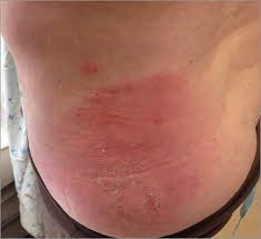 These present approximately 6 days after infection. Pin On Health Krikor Nalbandian