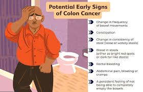 colon cancer symptoms ses and