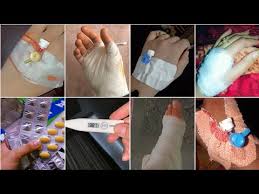 accident dp ideas 2023 hand bandage