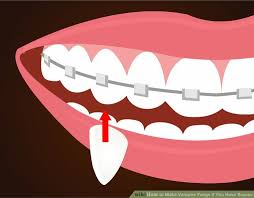 This is called sexual dimorphism. How To Make Vampire Fangs If You Have Braces 12 Steps Vampire Fangs Vampire Costume Diy Vampire Costumes