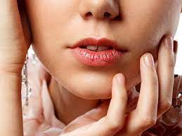 health reasons behind chapped lips