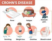 Fatigue symptom of Crohn's disease