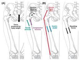 biomechanical study of proximal femur