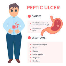 peptic ulcer gastro specialist dr