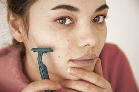 The process involves inserting a needle probe under the skin into the hair follicle. 9 Best Facial Hair Removal Ideas For Women How To Remove Upper Lip Brow And Chin Facial Hair