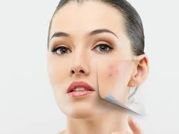 anti pigmentation creams get rid of