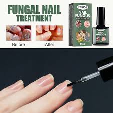 nail care repair liquid nail antifungal