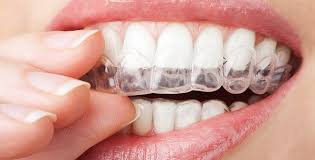 Yes i im getting my braces on un 20 days i have to wear a retainer with my braces because of my over bite so you don't nock off your bottom brackets. How To Maintain Orthodontic Treatment Smiles Unlimited Family Dentist