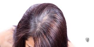 Grey or white hair is one the most embarrassing condition for people especially women, if premature graying will occur at teenage or small age then this will be a worse condition here, we are discussing some of home remedies, caring tips and white hair treatments to have black, long and shiny hair. 7 Home Remedies For Grey Hair Treatment Ahs Uae
