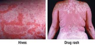 rash guide causes symptoms and