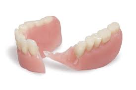 denture repair things you need to know