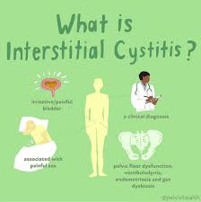 beating intersial cysis