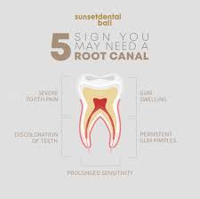 root c sunset dental bali