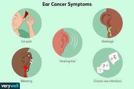 ear cancer types causes and treatments