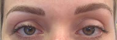semi permanent eye brows laser