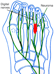 Image result for feet nerves chart