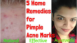 pimple marks scars removal at home