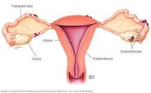 what-endometriosis-means
