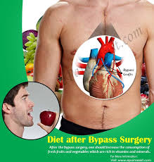 Diet After Bypass Surgery Foods To Take Foods To Avoid