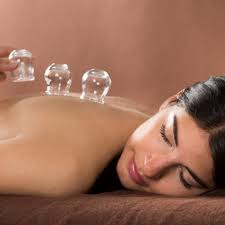 cupping therapy illinois goodlife