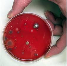 bacteria growing experiments in petri