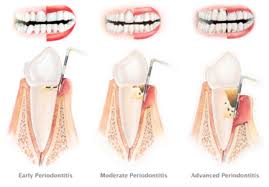 Image result for periodontist
