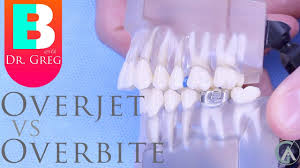 Maybe you would like to learn more about one of these? What Is An Overbite Braces Surgery For Correction