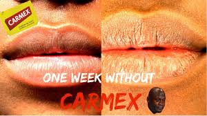 one week without carmex you