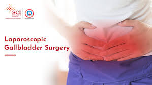 laparoscopic gallbladder surgery post