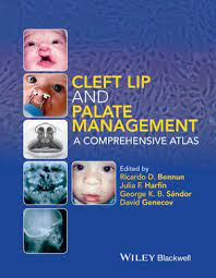 cleft lip and palate management a