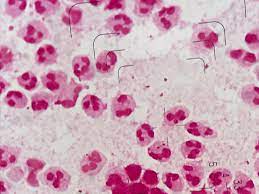 Neisseria gonorrhoeae〔淋菌〕 | グラム染色: Gram Stain