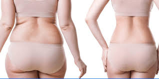 stop losing weight after gastric sleeve