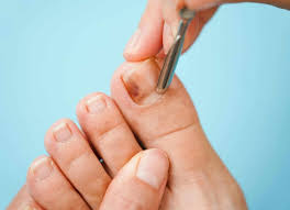 fungal nail treatment uk stratum clinics