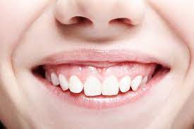 do small teeth cause a gummy smile