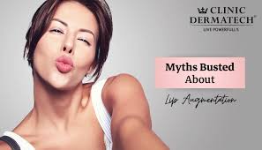 myths busted about lip augmentation