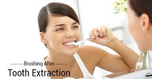 brushing after tooth extraction