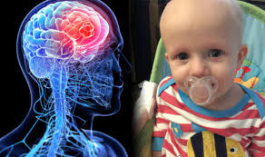 Brain tumors in children almost always originate in the base of the brain near the brainstem. Cancer Symptoms And Signs Two Year Old S Constant Tiredness Turned Out To Be Brain Tumour Express Co Uk