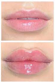 russian lips at suddenly slimmer med