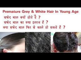 what causes white hair at early age