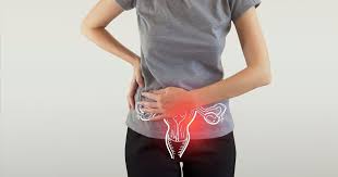 Ovarian cancer symptoms are similar to many common conditions, so they can be hard to detect. Ovarian Cancer Signs Of Ovarian Cancer Symptoms Familydoctor Org