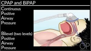 cpap vs bipap machines structural