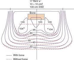 electron beam therapy dosimetry