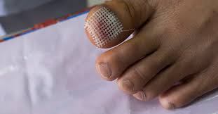 toe infection symptoms causes and