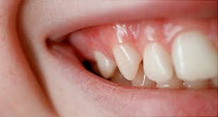 teeth and gums say about your health