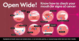 mouth and throat cancers