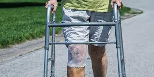 stiffness after knee replacement