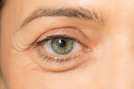 Eyelid Ptosis: Causes, Types, Diagnosis, and Surgery