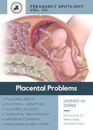 Different types of placenta previa are defined by the degree of overlap of the cervix: Pregnancy Spotlight Placental Abnormalities