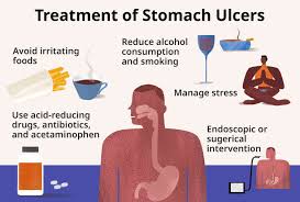 stomach ulcer types causes and symptoms