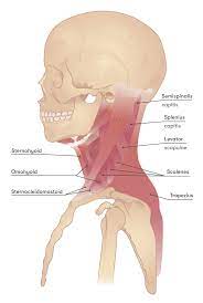 neck spasms symptoms causes